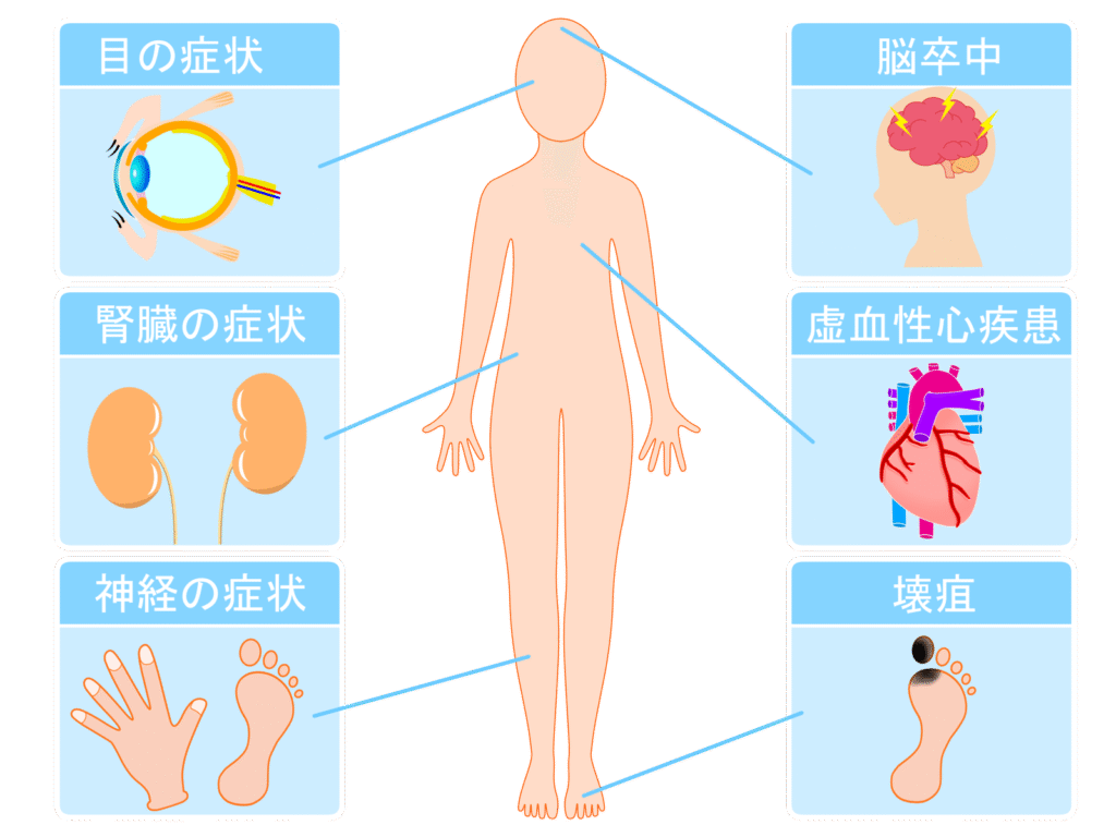 怖い糖尿病の合併症