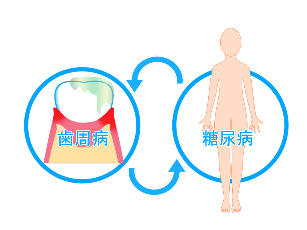 歯周病との関連
