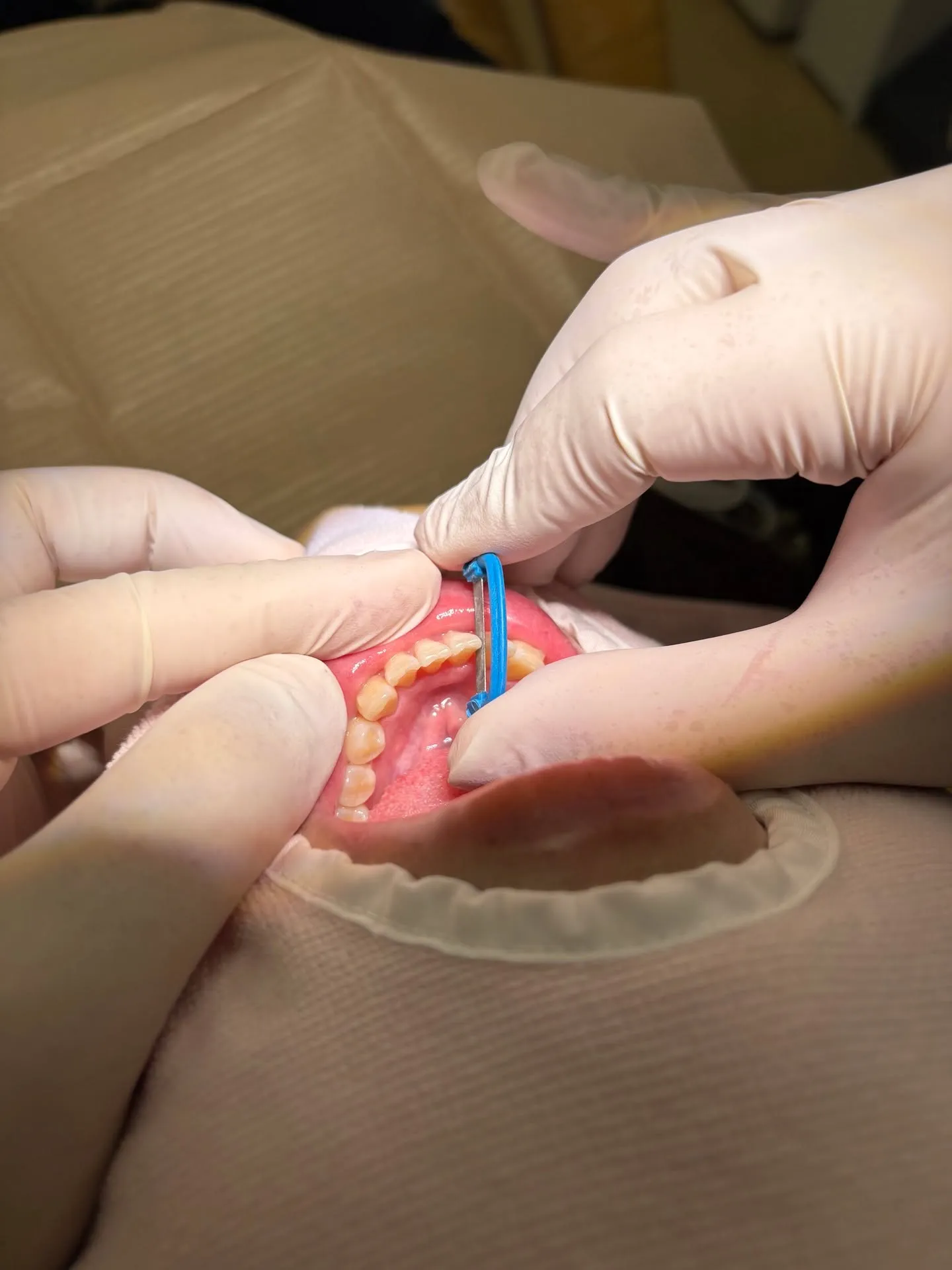 歯を抜かずに矯正!こんにちは!神戸元町 玉川歯科医院です🙂