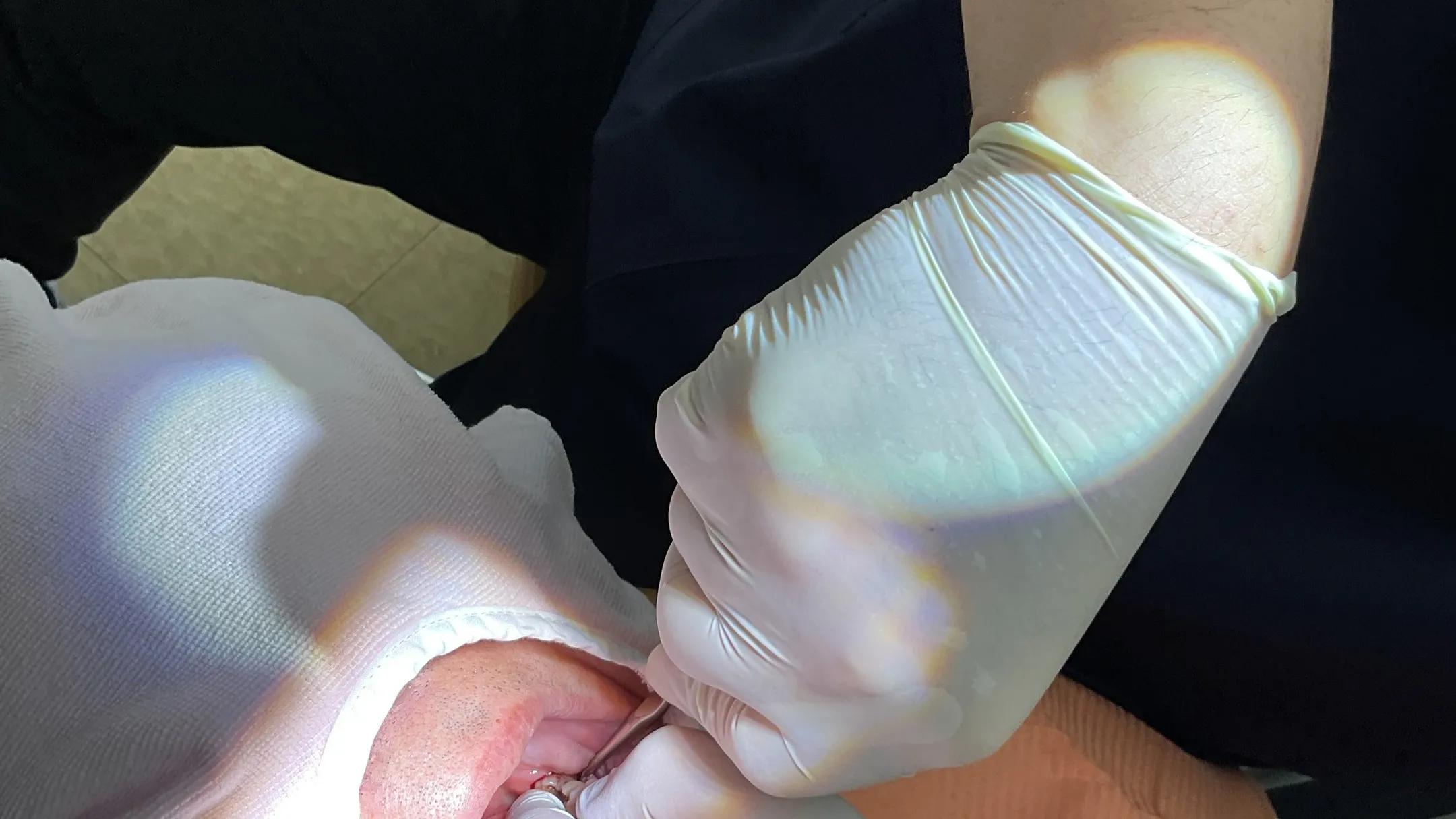 抜歯についてご紹介!神戸元町 玉川歯科医院です🙂